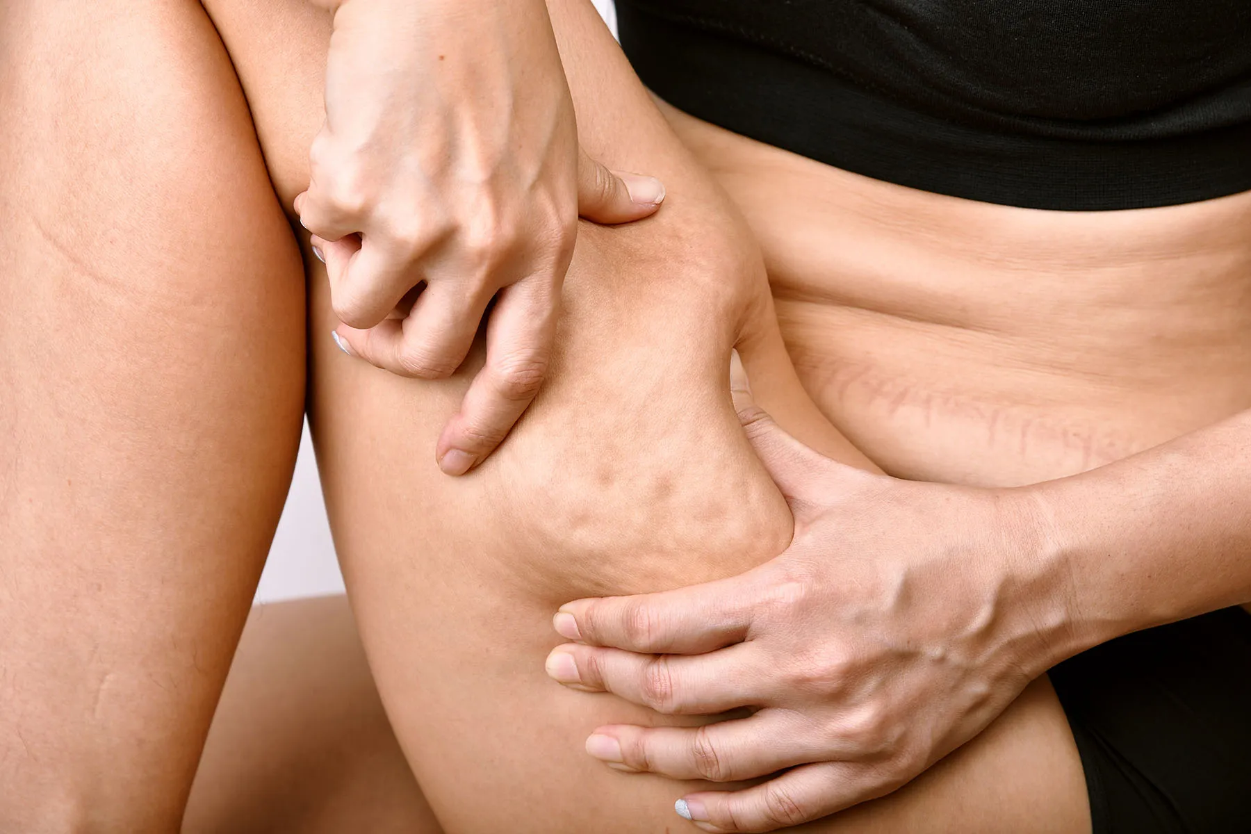 Traitement anti cellulite à Rabat : découvrez la solution Infraslim
